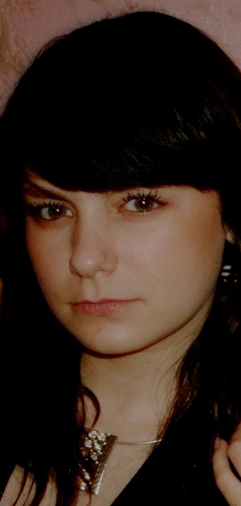 Анна Швец | Синяк