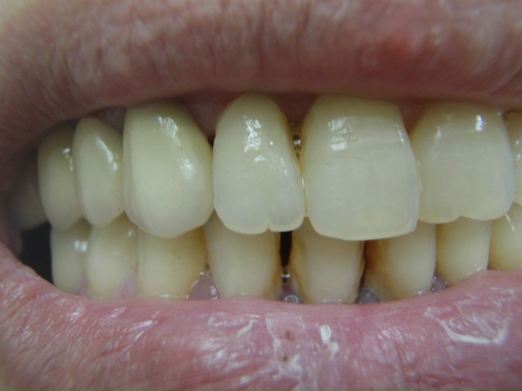 Эрнест Абрамян | Москва