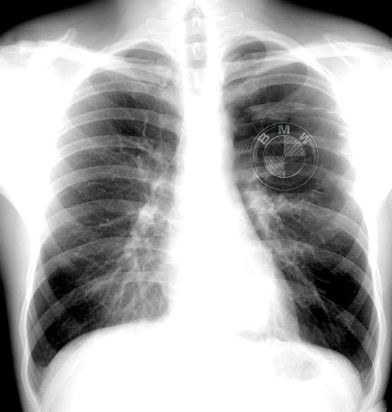 Pit Bull | Санкт-Петербург