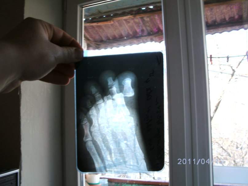 Кыцян Барбазян | Гагра