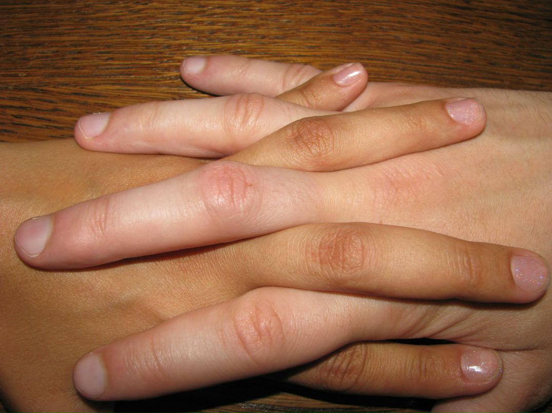 Лаура Мужаева | Калининград