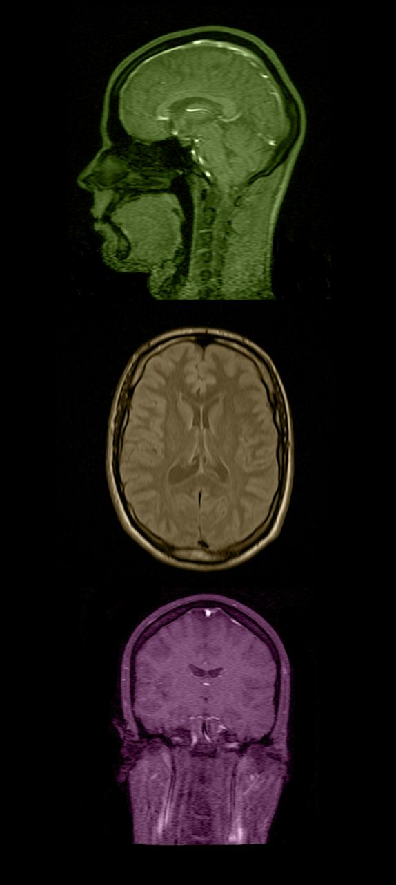 Евгений Загвоздкин | Москва