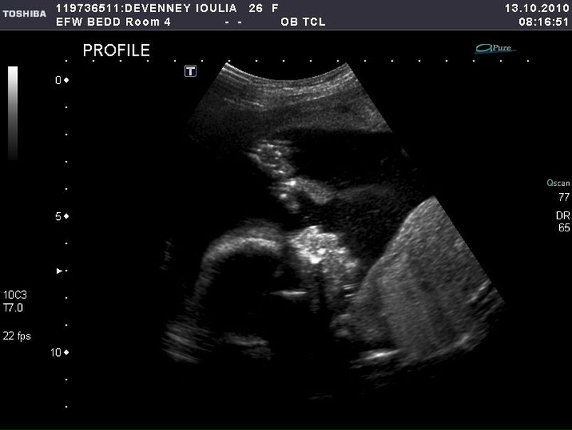 №29, Юлия Жильцова, Calgary №29, Юлия Жильцова, Calgary