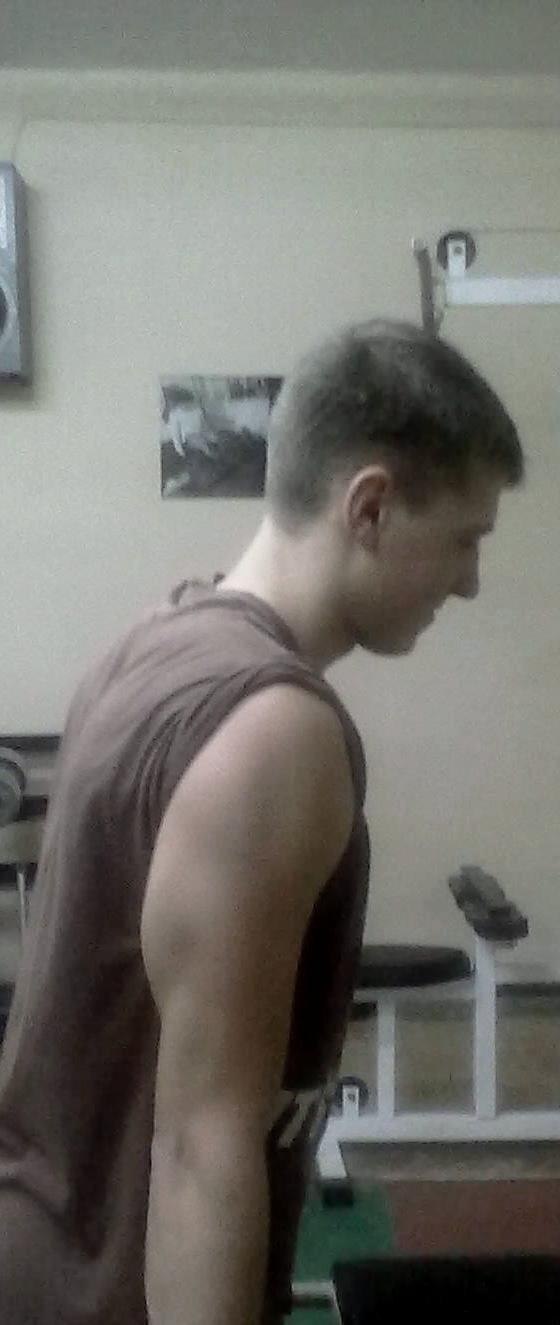 Юрий Рольский | Березнеговатое