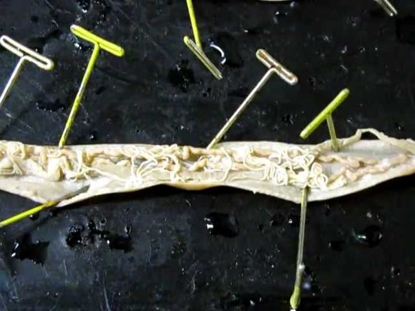 Roundworm