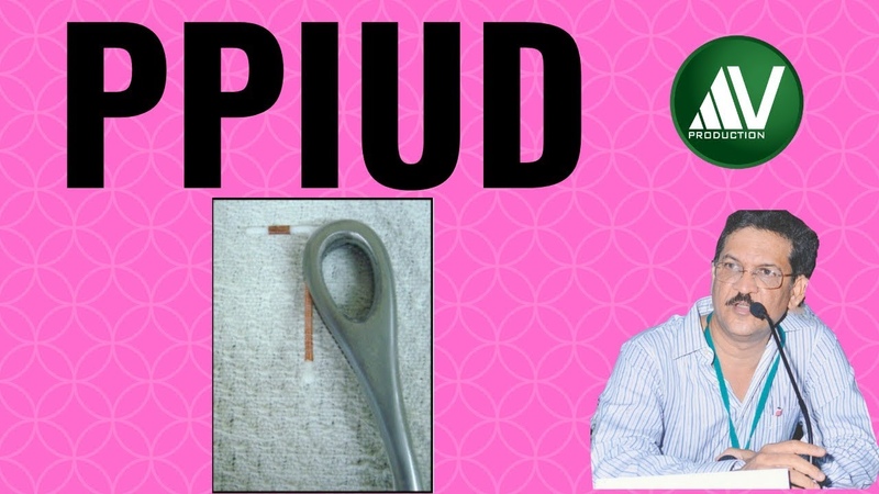 Postpartum ( Postplacental) Intrauterine Device ( PPIUD) Insertion