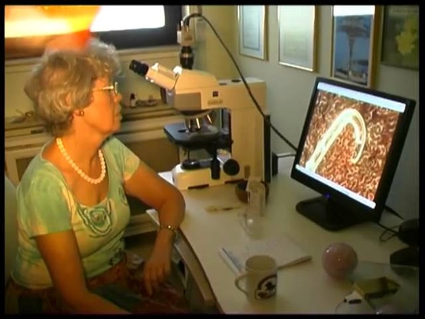 Morgellons in Deutschland Parasiten im Blut